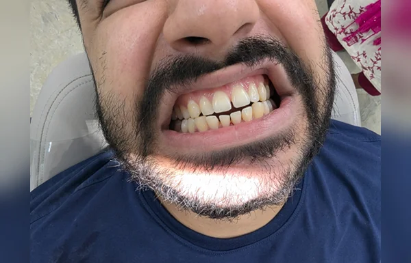 Treatments